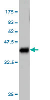 ALAS1 monoclonal antibody (M01), clone 3G10