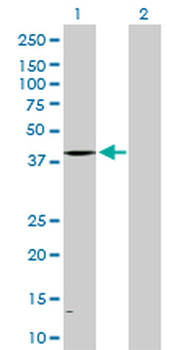 ALAD purified MaxPab rabbit polyclonal antibody (D01P)