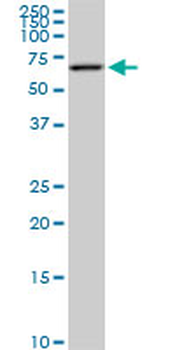 AKT2 monoclonal antibody (M05), clone 1F3