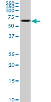 AKT2 monoclonal antibody (M05), clone 1F3