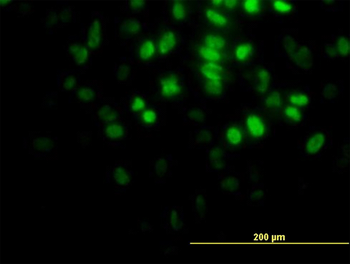 AKT2 monoclonal antibody (M05), clone 1F3