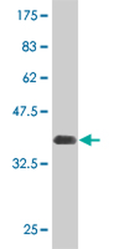 AKT2 monoclonal antibody (M05), clone 1F3