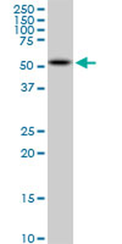 AKT2 monoclonal antibody (M04A), clone 1F8