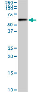 AKT2 monoclonal antibody (M03), clone 1D9