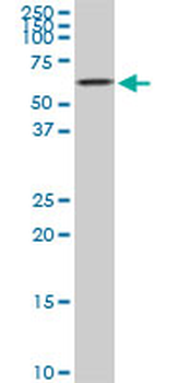 AKT2 monoclonal antibody (M03), clone 1D9