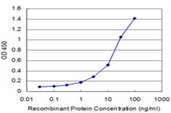 AKT2 monoclonal antibody (M03), clone 1D9
