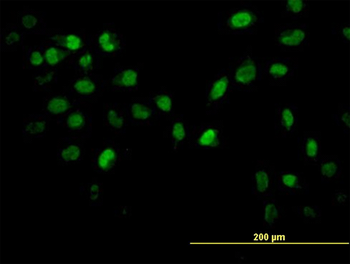AKT2 monoclonal antibody (M03), clone 1D9