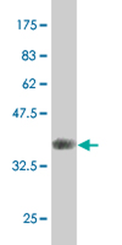AKT2 monoclonal antibody (M03), clone 1D9