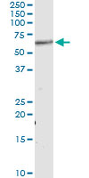AKT1 monoclonal antibody (M01), clone 4C3