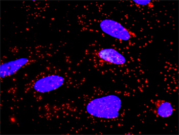 AKT1 monoclonal antibody (M01), clone 4C3