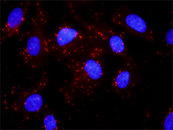 AKT1 purified MaxPab rabbit polyclonal antibody (D01P)