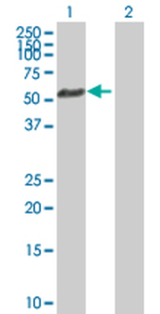 AKT1 purified MaxPab rabbit polyclonal antibody (D01P)