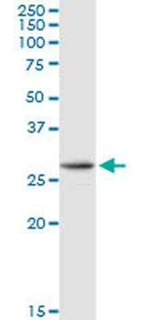 AK2 purified MaxPab rabbit polyclonal antibody (D01P)