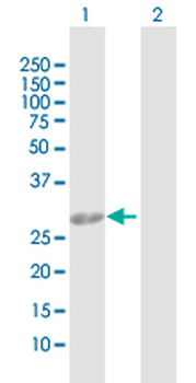 AK2 purified MaxPab rabbit polyclonal antibody (D01P)