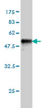 AK1 monoclonal antibody (M09), clone M2