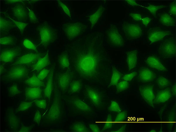 AK1 monoclonal antibody (M08), clone M1