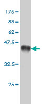 AK1 monoclonal antibody (M08), clone M1