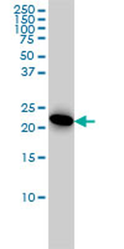 AK1 monoclonal antibody (M06), clone 3A6-1F5