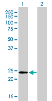 AK1 monoclonal antibody (M06), clone 3A6-1F5