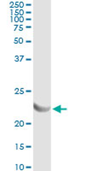 AK1 monoclonal antibody (M06), clone 3A6-1F5