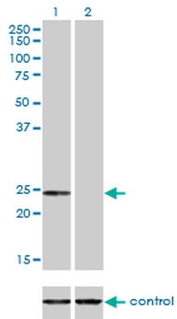 AK1 monoclonal antibody (M06), clone 3A6-1F5