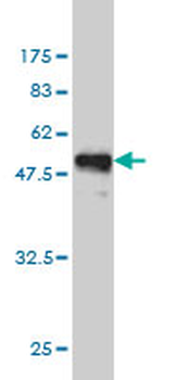 AK1 monoclonal antibody (M06), clone 3A6-1F5