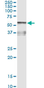 AHSG monoclonal antibody (M02), clone 1D8