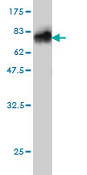 AHSG monoclonal antibody (M01), clone 5D8