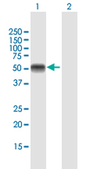 AHSG MaxPab mouse polyclonal antibody (B01)