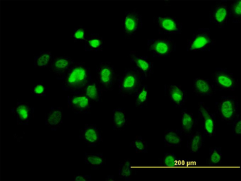 AHR monoclonal antibody (M02), clone 3B12