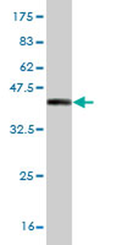 AHR monoclonal antibody (M02), clone 3B12