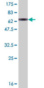 AHCY monoclonal antibody (M08A), clone M1