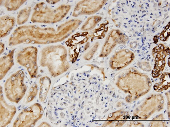 AGT monoclonal antibody (M04), clone 3C10