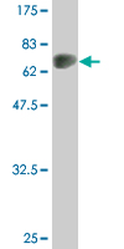 AGT monoclonal antibody (M04), clone 3C10