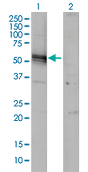 AGT monoclonal antibody (M01), clone 1A10