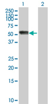 AGT purified MaxPab rabbit polyclonal antibody (D01P)