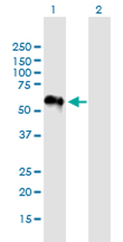 AGER monoclonal antibody (M02J), clone 1C1