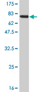 AGER monoclonal antibody (M02J), clone 1C1