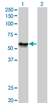 AGER monoclonal antibody (M02), clone 1C1
