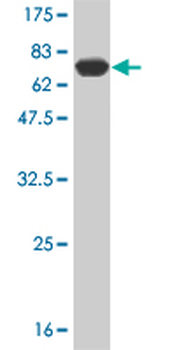 AGER monoclonal antibody (M02), clone 1C1