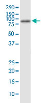 AFP MaxPab rabbit polyclonal antibody (D01)