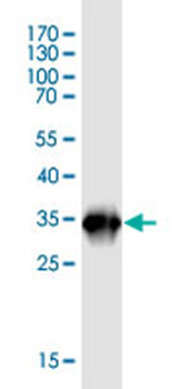 AP2B1 monoclonal antibody (M01J), clone 2D5