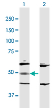 ADSL purified MaxPab rabbit polyclonal antibody (D01P)