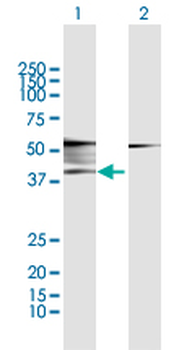 ADRB2 MaxPab rabbit polyclonal antibody (D01)