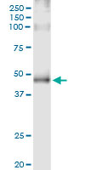 ADRB2 MaxPab rabbit polyclonal antibody (D01)