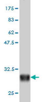 ADRA1A monoclonal antibody (M01), clone 4C7
