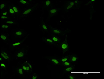 PARP1 monoclonal antibody (M02), clone 2C7