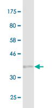 PARP1 monoclonal antibody (M02), clone 2C7
