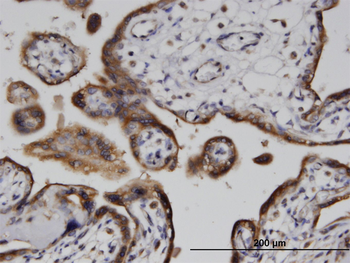ADPRH monoclonal antibody (M04), clone 1F11