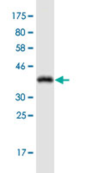 ADORA2A monoclonal antibody (M17), clone 4E4